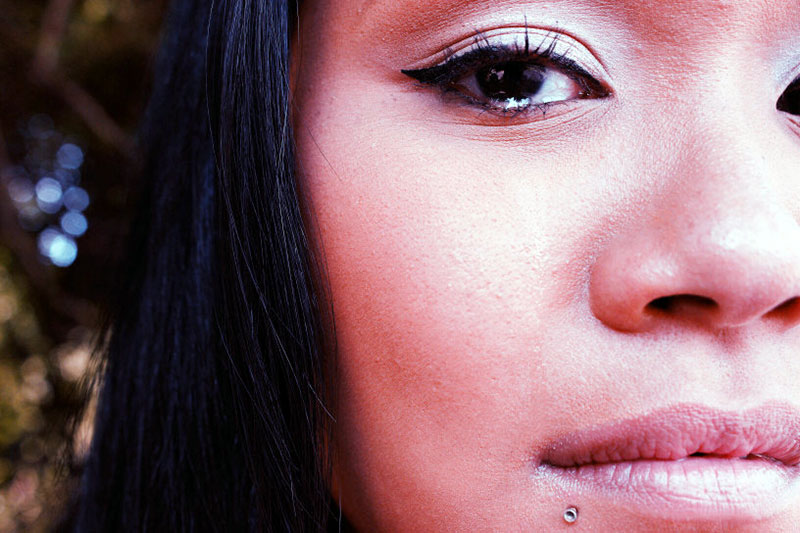 Eyelid Surgery in NYC